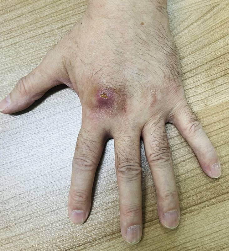 เชื้อราแมว