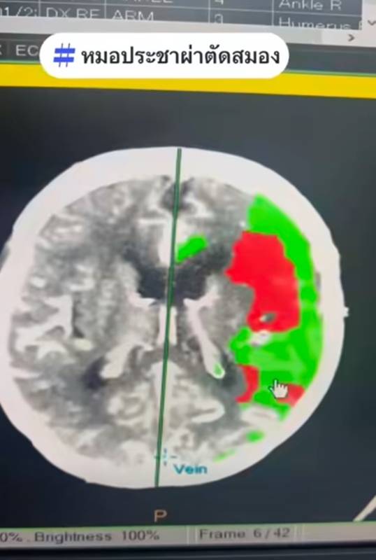 ดื่มกาแฟแล้วใจสั่น