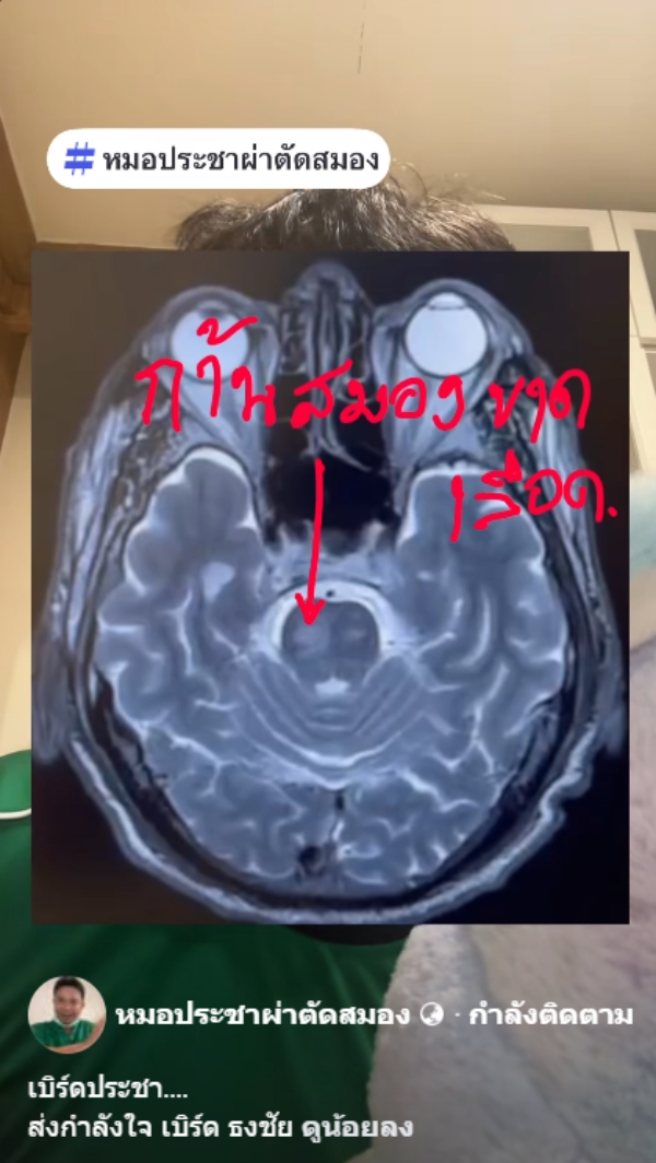 หมอผ่าตัดสมอง