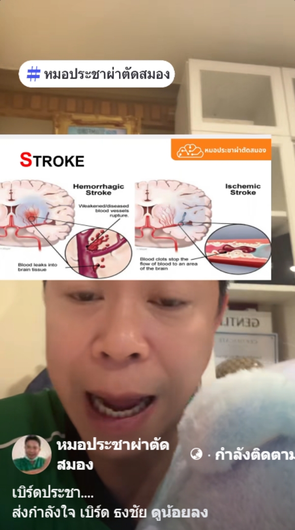 หมอผ่าตัดสมอง