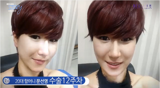 ศัลยกรรม