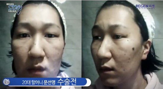 ศัลยกรรม