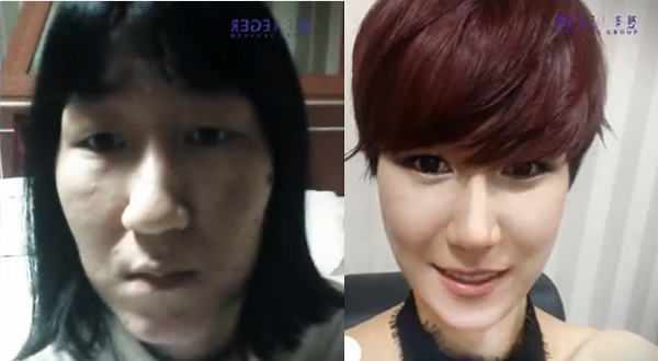 ศัลยกรรม