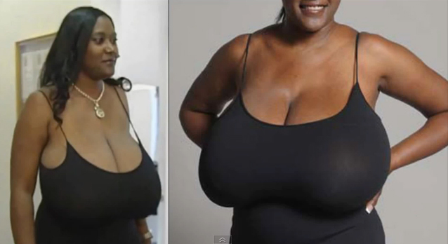 ศัลยกรรม