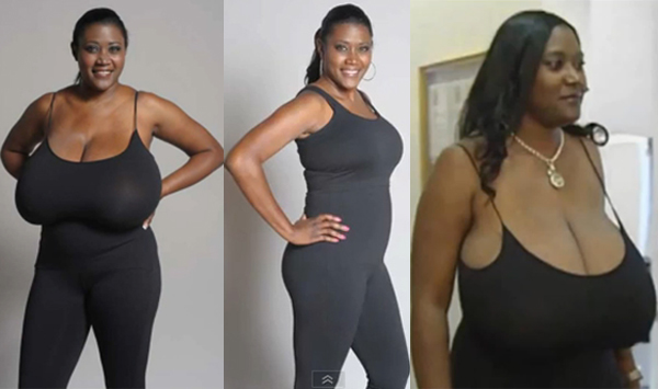 ศัลยกรรม