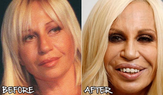 เสพติดศัลยกรรม