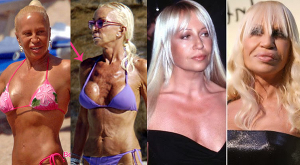 เสพติดศัลยกรรม