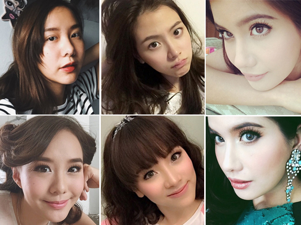 คอนแทคเลนส์