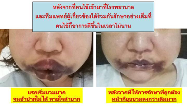 ศัลยกรรม
