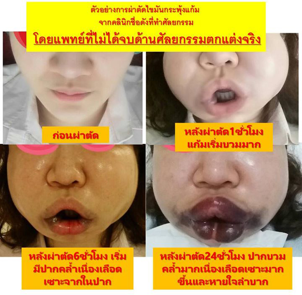 ศัลยกรรม