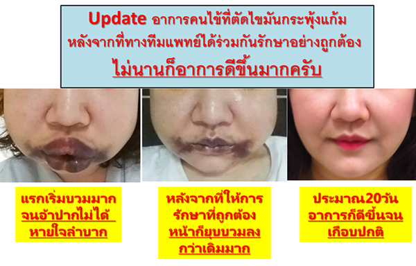 ศัลยกรรม