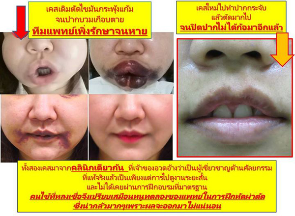 ศัลยกรรม