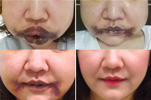 ศัลยกรรม