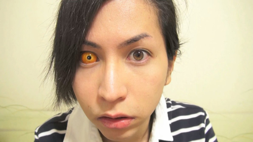 คอนแทคเลนส์