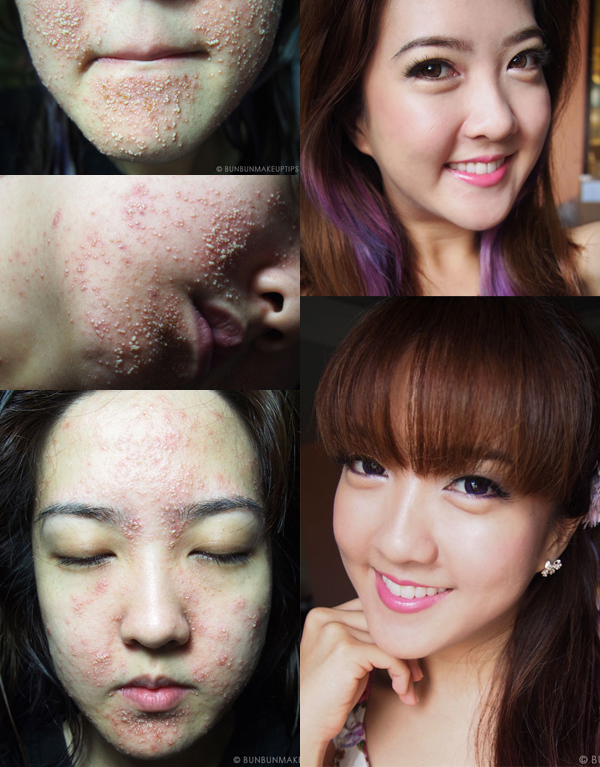 บล็อกเกอร์หน้าพัง 