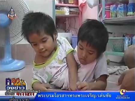 ปิ่น ปาน แฝดสยาม นครสวรรค์