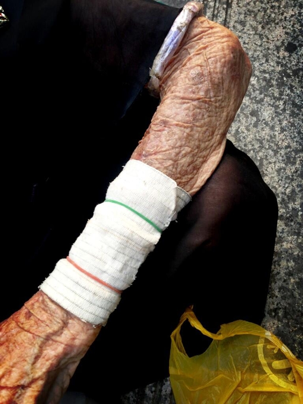 ไมค์ พิรัชต์ น้ำใจงาม ช่วยคุณยายพิการหน้าบีทีเอส