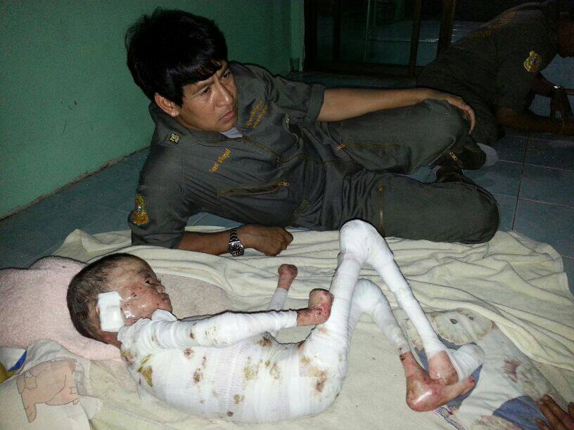 น้องโชคดี เด็กดักแด้