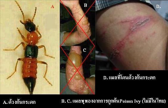  แมลงก้นกระดก 