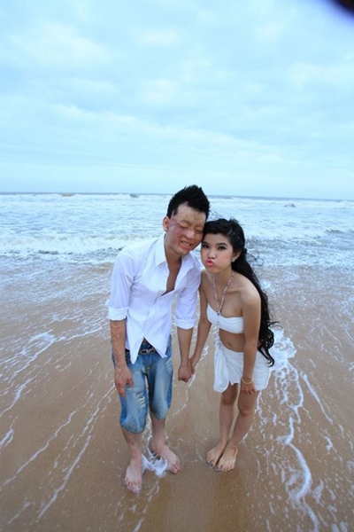 สาวเวียดนามแต่งงานกับหนุ่มเสียโฉม