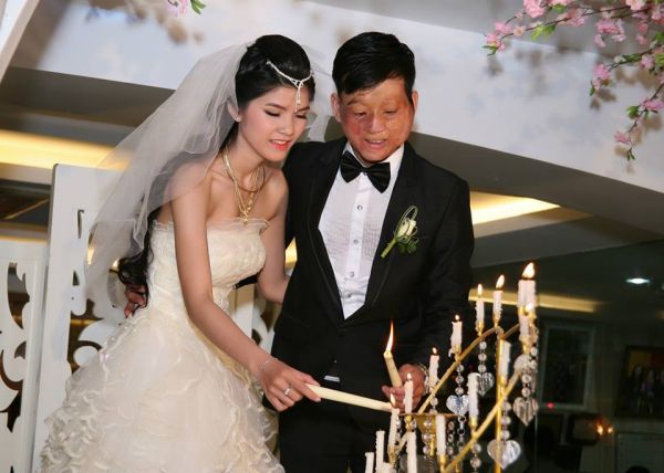 สาวเวียดนามแต่งงานกับหนุ่มเสียโฉม