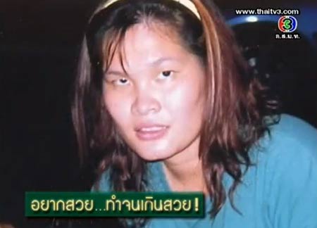 ตีสิบ ย้อนหลัง อุทาหรณ์.. เสพติดศัลยกรรม จากคน(เคย)สวย ส้ม นลินภัทร ชัยเรืองกิตต์ 
