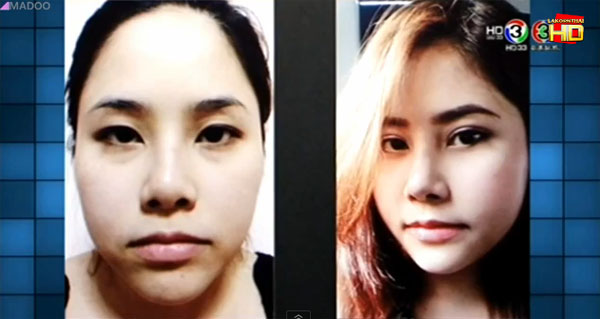 พิมพ์ พิมพ์ธารา สาวไทยทำศัลยกรรมฟรีที่เกาหลี 