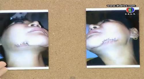 เบื้องหลัง 6 ดาราศัลยกรรม สวย-สยอง ในรายการ 3 แซบ