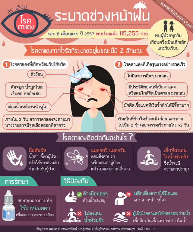 โรคตาแดงระบาดหนัก พบป่วยแล้วนับแสนราย ตั้งแต่ต้นปี 