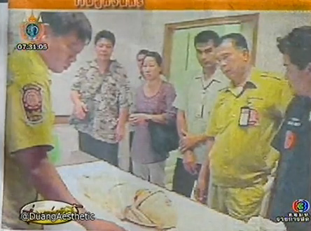 สุนัขกัด