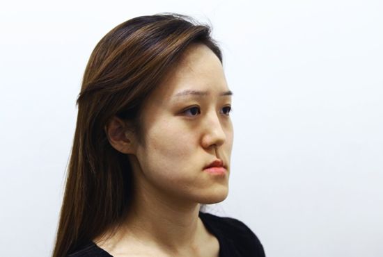 ฝาแฝดเกาหลีศัลยกรรม