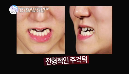 ฝาแฝดเกาหลีศัลยกรรม