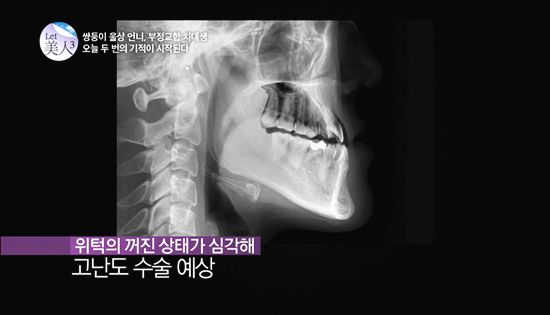 ฝาแฝดเกาหลีศัลยกรรม