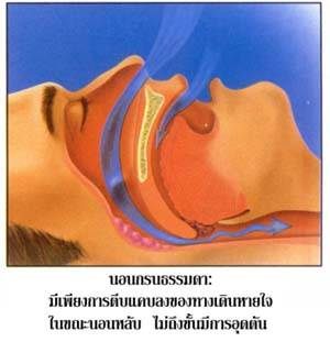 การนอนกรนปกติ การนอนกรนปกติ