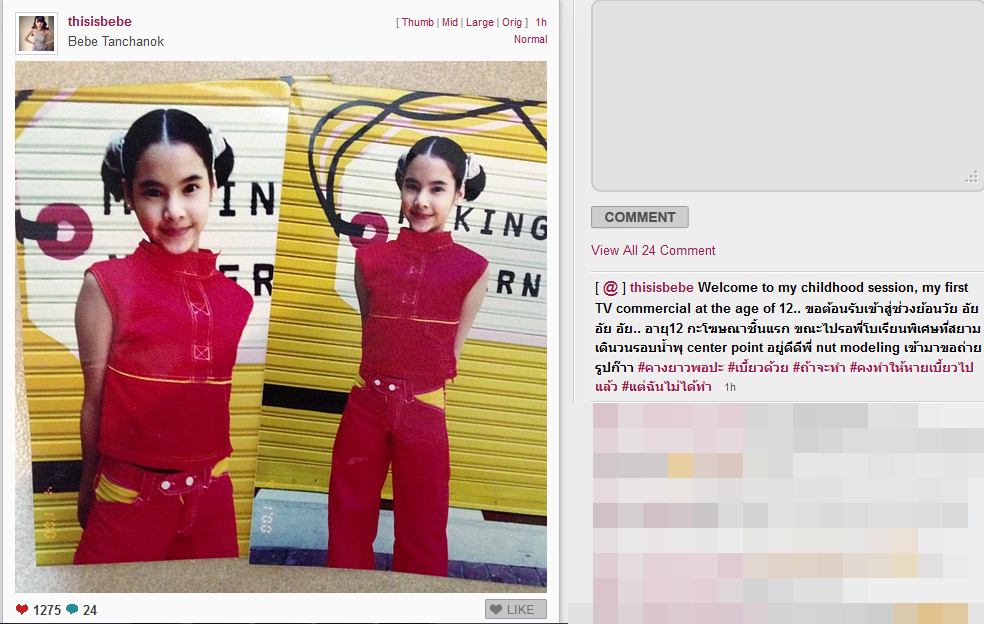 เบเบ้ ศัลยกรรม