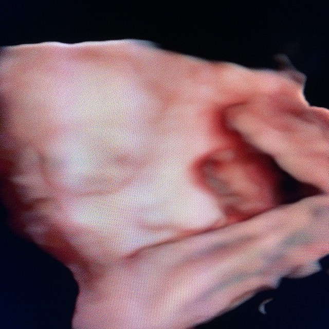 ดอม เปล่งพานิช