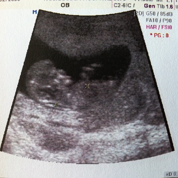 ต่อ นันทวัฒน์ 