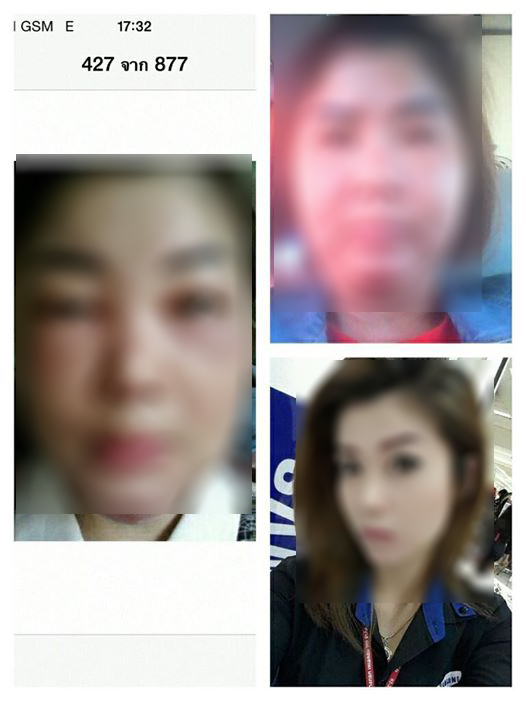 สาวฆ่าตัวตาย หลังหน้าพังเพราะหมอกระเป๋า