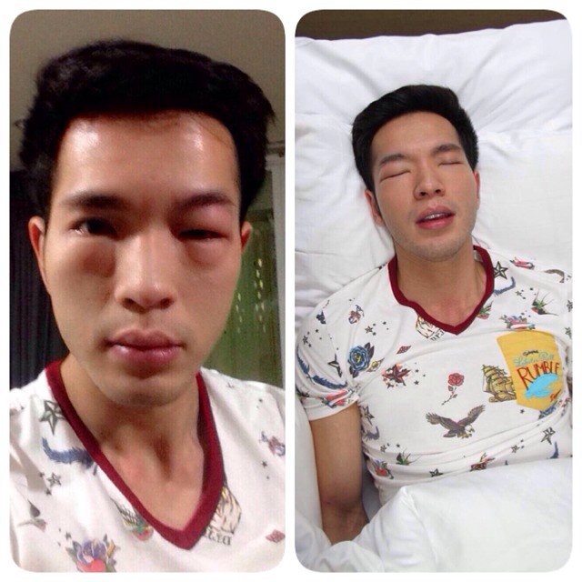 บอย โชคชัย