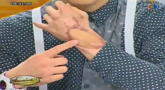 แอนดี้ เขมพิมุก