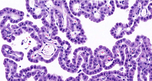 เชื้อไวรัส MERS-CoV