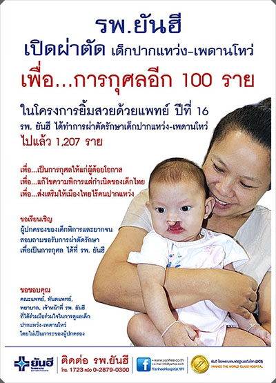รพ.ยันฮี เปิดโครงการผ่าตัดเด็กปากแหว่ง-เพดานโหว่ ฟรี!! 26 มี.ค.นี้
