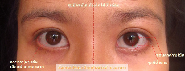 เสพติดบิ๊กอาย