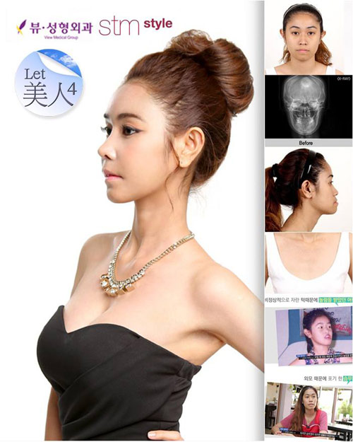 2 สาวไทยร่วมรายการ Let me in ศัลยกรรมเปลี่ยนชีวิตชั่วข้ามคืน