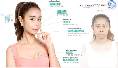 2 สาวไทยร่วมรายการ Let me in ศัลยกรรมเปลี่ยนชีวิตชั่วข้ามคืน