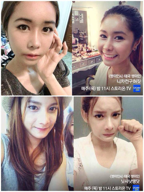 2 สาวไทยร่วมรายการ Let me in ศัลยกรรมเปลี่ยนชีวิตชั่วข้ามคืน