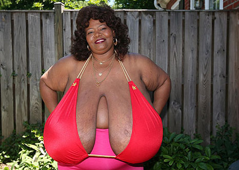 แอนนี่ ฮอว์กินส์ เทอร์เนอร์ ผู้หญิงที่หน้าอกใหญ่ที่สุดในโลก