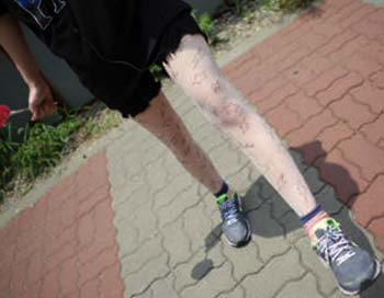 ถุงน่อง