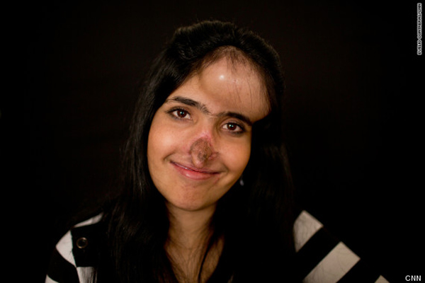 ไอชา โมฮัมหมัดซาอิ