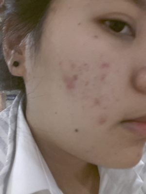 เคล็ดลับความสวย